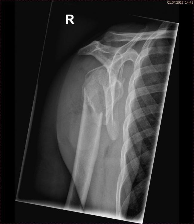 M.B. Seq.6 W SCHULTER Y-AUFNAHME A.P_.jpg