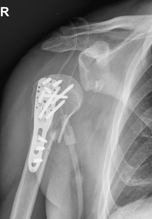 M.B. Seq.7 W SCHULTER A.P_.jpg