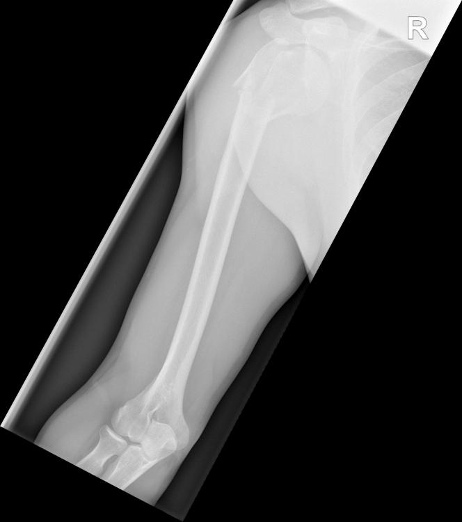 M.B. Seq.1 W OBERARM A.P_.jpg