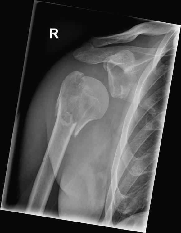 M.B. Seq.5 W SCHULTER A.P_.jpg