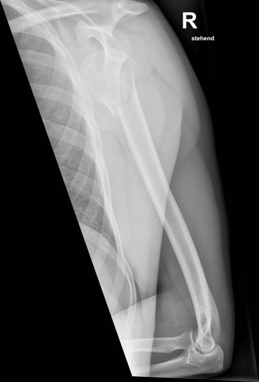 M.B. Seq.4 W OBERARM LAT.jpg