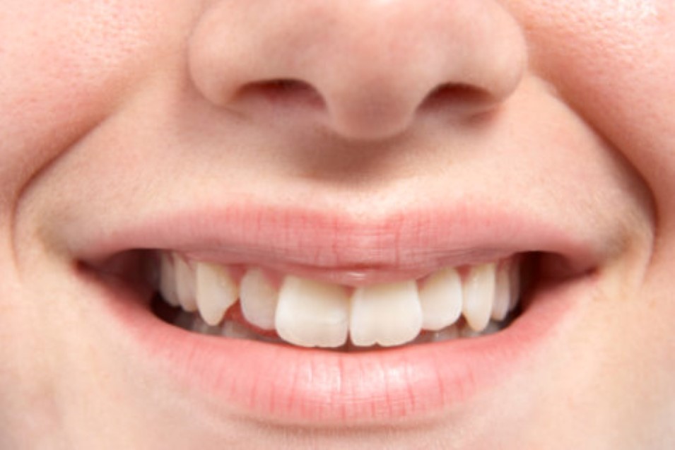 Mehr Informationen zu "Natürliche Zähne sind Top - Hollywood Lächeln ist out"