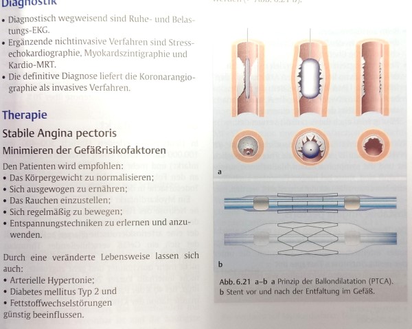 Pulmologie |  Angina Pectoris