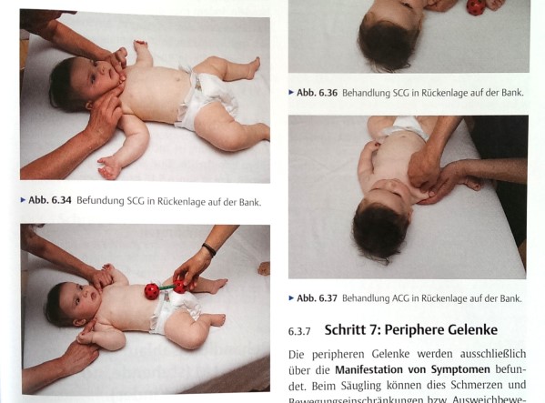 Dorn Befund Kopfrotation